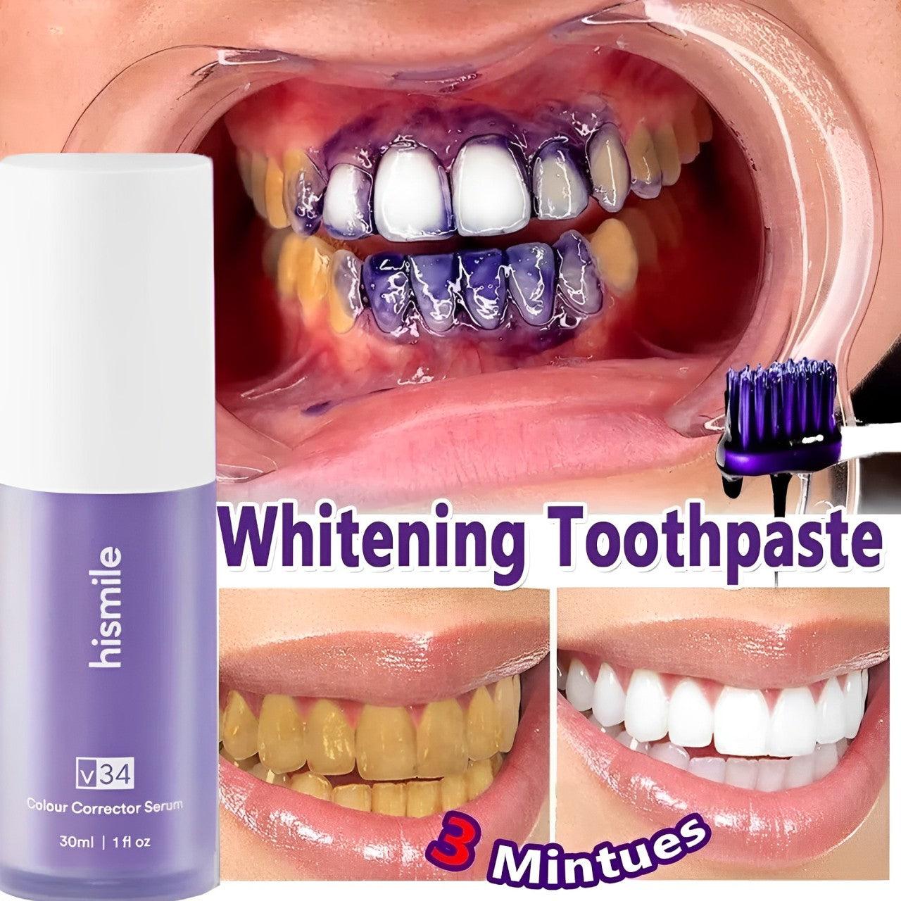 hismile Teeth whitener remove yellow stains