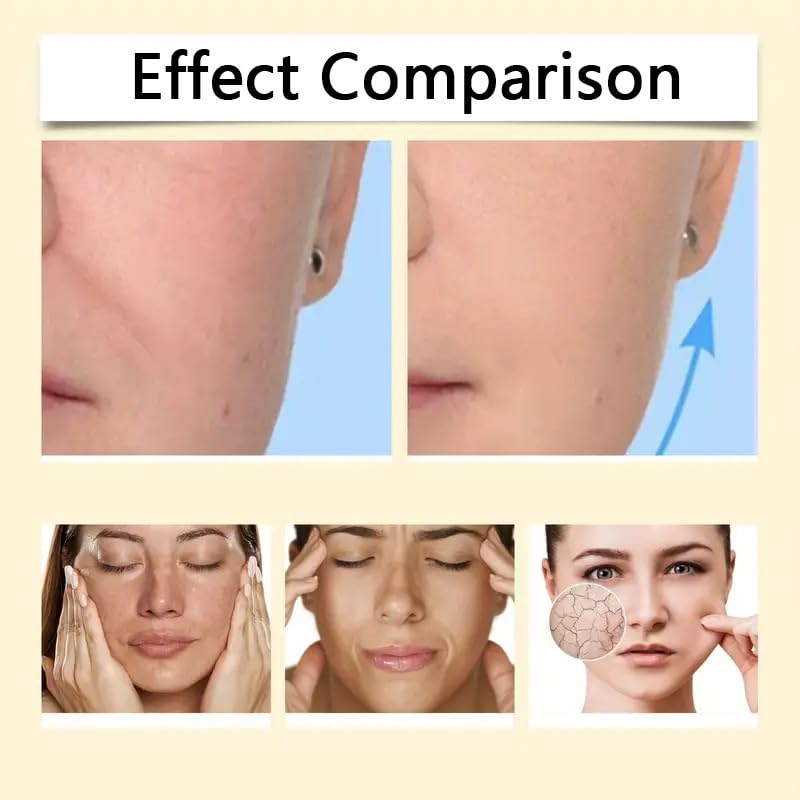 Bee Venom Skincare Cream with Collagen Boosting Ingredients